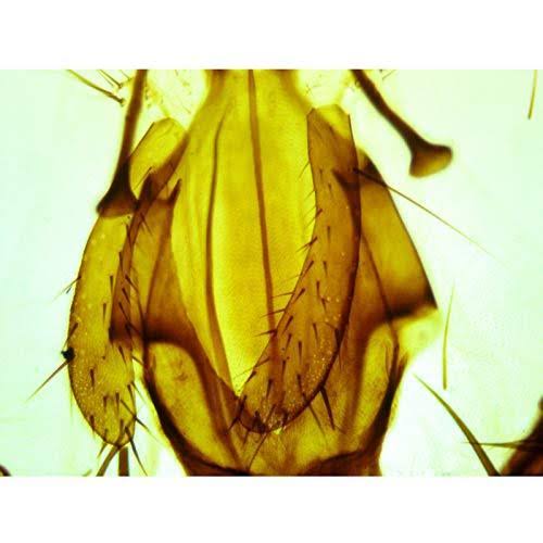 40X-2000X Binocular Lab Compound Microscope with Double Layer Mechanical Stage D778836